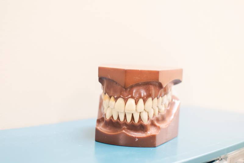 Je grince des dents la nuit que faire conseil de dentiste  Marseille Dr Guillaume GOSSIN